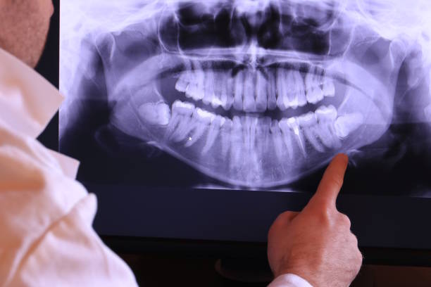 Best Emergency Dental Extractions in Kamiah, ID