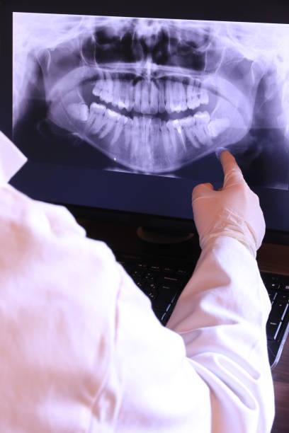 Best Emergency Dentist for Knocked-Out Tooth in Kamiah, ID